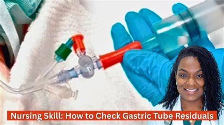 How often do you check tube feeding residuals
