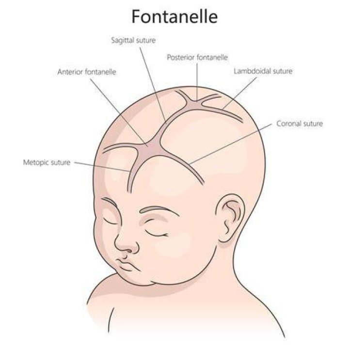 When should I worry about a sunken fontanelle